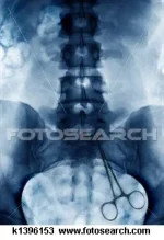 medical-malpractice-x_~k1396153.webp