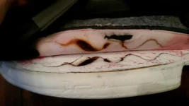 Genny Seat Damage.webp Genny Seat Damage.webp